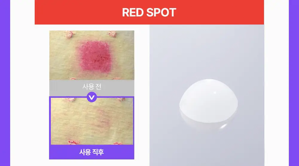 [나띠PICK][잡티케어] 더마펌 수딩 리페어 토닝 세럼 R4 30ml 기획 (+리필 30ml) 상세페이지 19